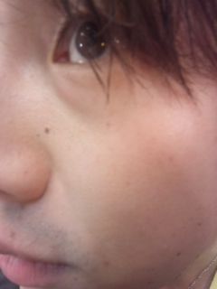 マイ鼻の横ボクロ